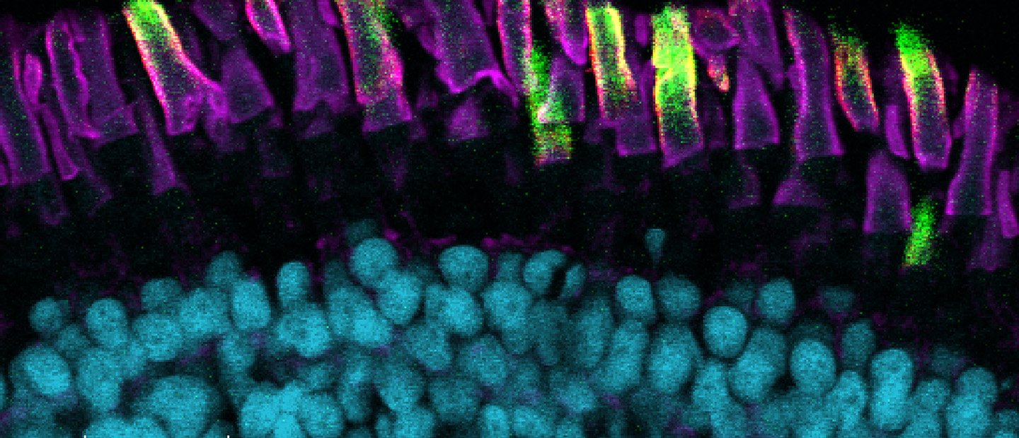 About Banner A cross section of eye tissue under a microscope.